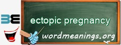 WordMeaning blackboard for ectopic pregnancy